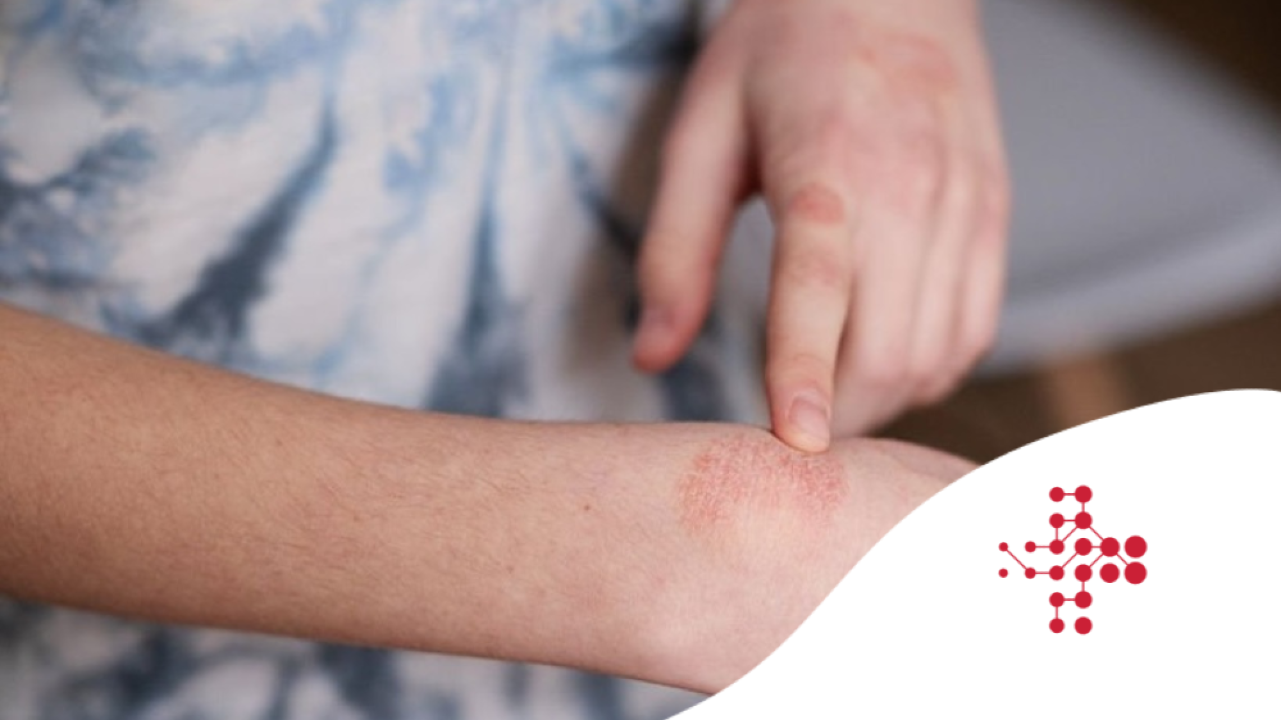 Dr. Lasso: Psoriáza pod lupou - nové naděje z kongresu EADV 2025